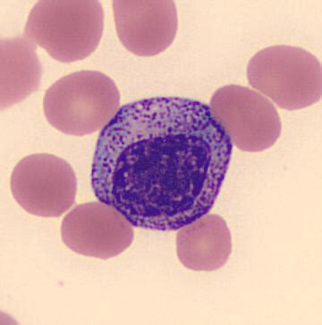 Difference Between Promyelocyte and Myelocyte | Promyelocyte vs Myelocyte