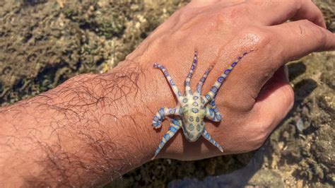 Blue-Ringed Octopus Bite Symptoms and Emergency First Aid