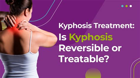 Kyphosis Treatment: Is Kyphosis Reversible or Treatable? - YouTube