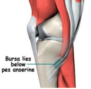 Pes Anserinus Pain Syndrome - Pregnancy Informations