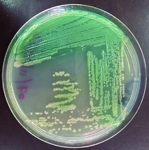 The growth of Pseudomonas aeruginosa on nutritional agar after 24 h of ...