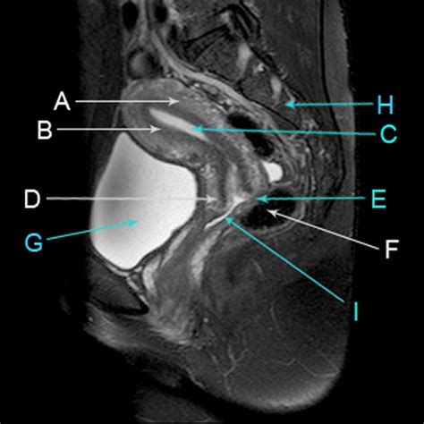 Mri Female Pelvis Anatomy Axial Im1age 2 Pelvis Anatomy Pelvis Hip ...