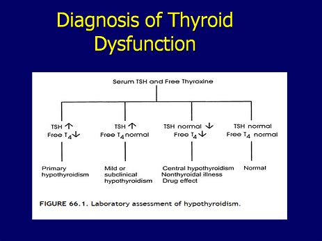 Essentials About Thyroid Hormones and Reverse T3