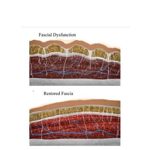 The Fascia System - Ohana Yoga Studio