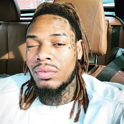 What happened to Fetty Wap's eye? | The US Sun