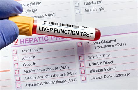 Everything You Should Know About Liver Function Tests - Prestige ER