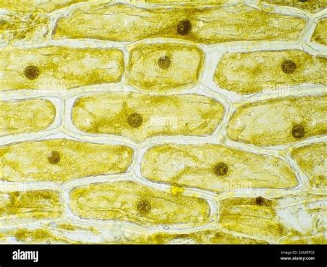 Plant Cell Under Microscope 40X Labeled : 1 - Chloroplast and cell wall ...