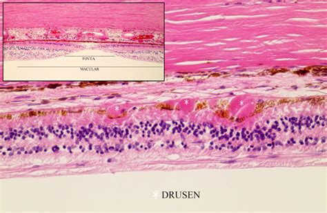 Fovea Histology