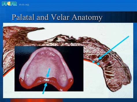 26.posterior palatal seal