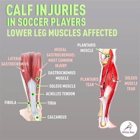 Do you keep pulling your calf ...? Learn more about Calf Muscle ...