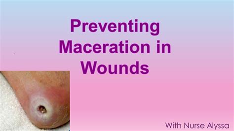 Preventing Maceration in wounds - YouTube