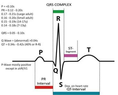 EKG basics | Pr interval, Nurse study notes, Nursing school notes