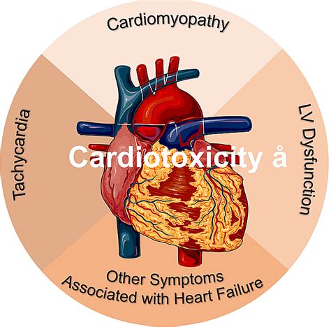 Association of Cardiotoxicity With Doxorubicin and Trastuzumab: A ...