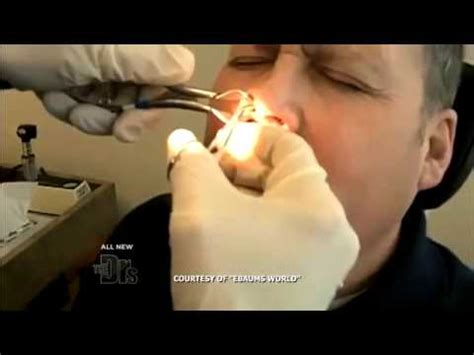 World s Biggest Booger Medical Course - YouTube