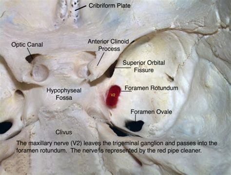 10_foramen_rotundum_v2.jpg (538×407) | Maxillary nerve, Radiology ...