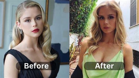 Erin Moriarty Plastic Surgery, Before & After | Myth or Reality ...