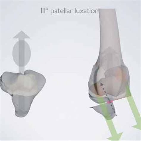 (PDF) Tibial Tuberosity Transposition Tool. A novel surgical technique ...