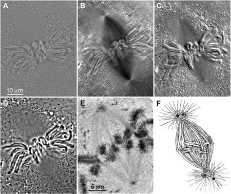 Mitosis Stages Under Microscope