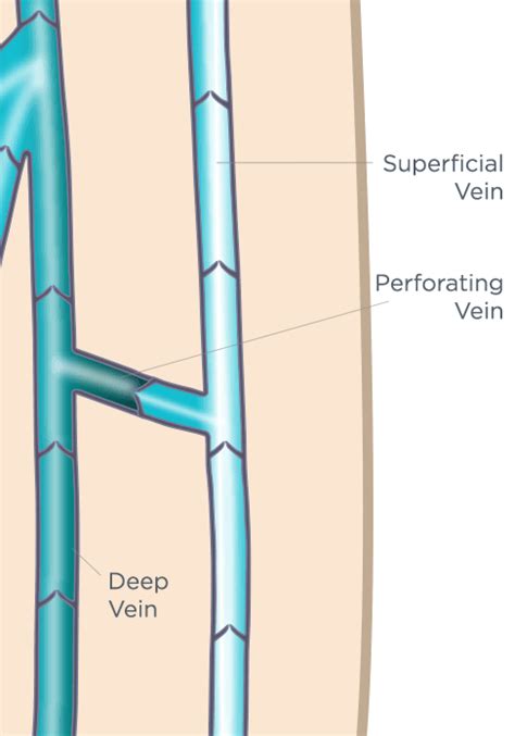 The Ultimate Vein Guide - An animated, illustrative guide to veins ...