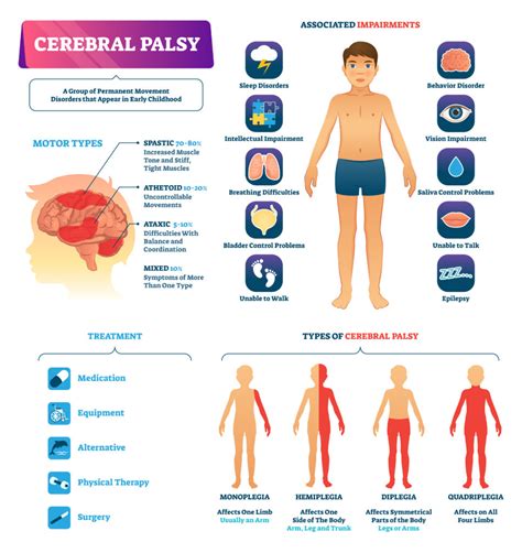 An Overview of the Types of Cerebral Palsy - Birth Injury Guide