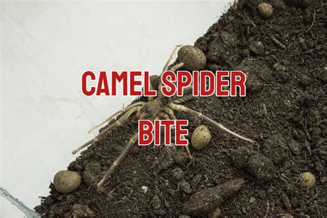 Camel Spider Bite: Symptoms And Treatment (with Pictures)