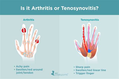 Flexor Tenosynovitis Causes