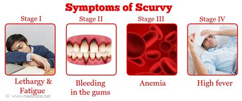 Scurvy - Causes, Symptoms, Diagnosis, Treatment & Prevention