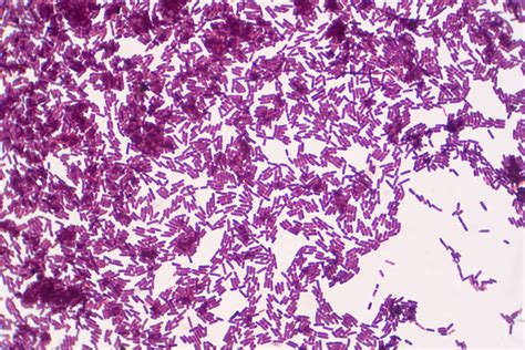 Bacillus Subtilis Gram Stain