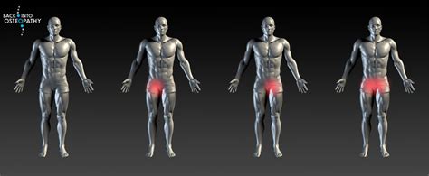 Groin Pain - What is it and Why?