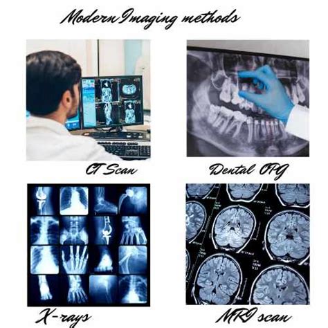 From X-rays To Mri's-exploring The Various Imaging Techniques ...