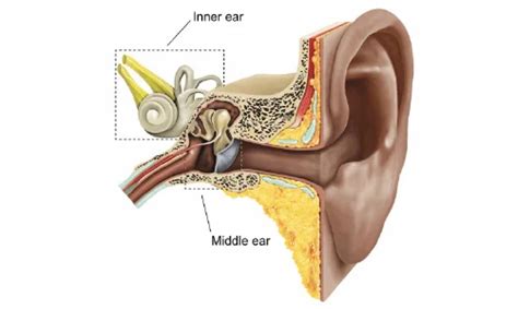 Stapedectomy Surgery: Procedure, Types & Recovery - CK Birla Hospital