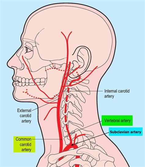 Vertebral Artery Segments, Stenosis and Artery Dissection Symptoms