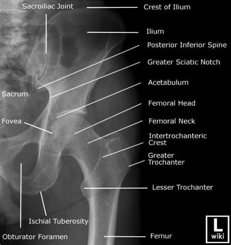 Hip X Ray Anatomy | SexiezPicz Web Porn