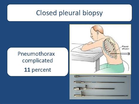 Pleural procedures Dr anan esmail parietal pleura supplied