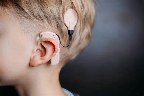 Cochlear Implants - Three Misunderstandings - Audiologist.co.uk