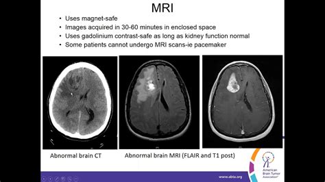 Brain Tumor Mri Without Contrast