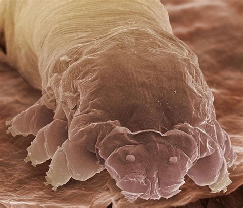 FACE OF EYELASH MITE | Things under a microscope, Demodex, Eyelash mites