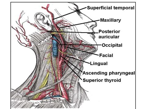 Carotid endarterectomy