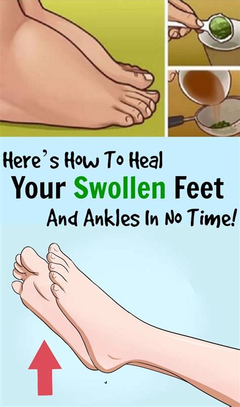 Swirlster First: Stop Feet From Swelling