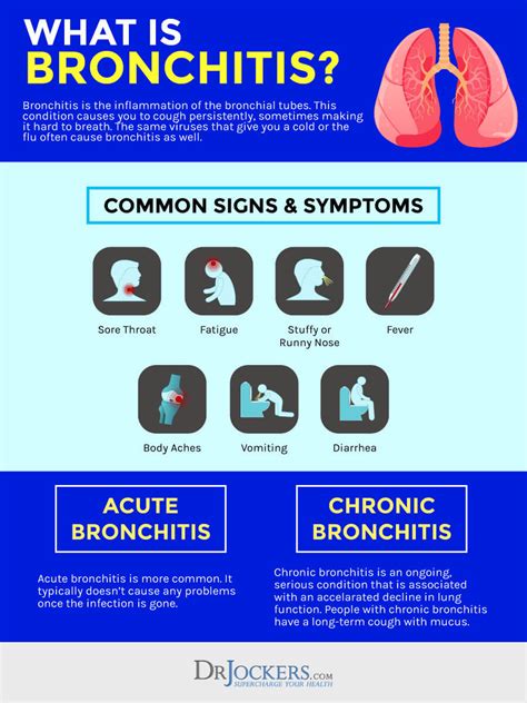 How To Cure Acute Bronchitis - Internaljapan9