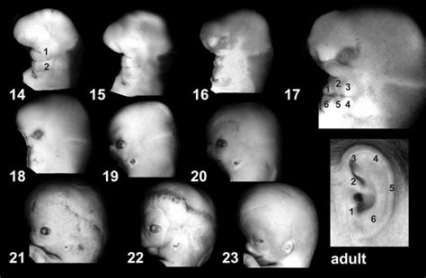 Hearing - Outer Ear Development - Embryology