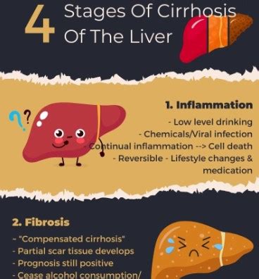 What Are The Four Stages Of Cirrhosis Of The Liver? - Abbeycare