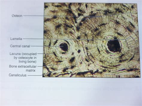 Osteon slide tissue histology | Anatomy and physiology, Tissue, Vintage ...