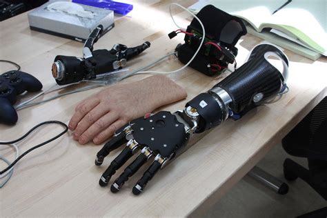 Robotic Prosthetic Arm Cost : Hackberry Is A Practical Prosthesis For ...