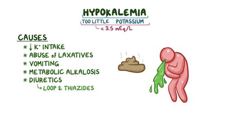 Hypokalemia