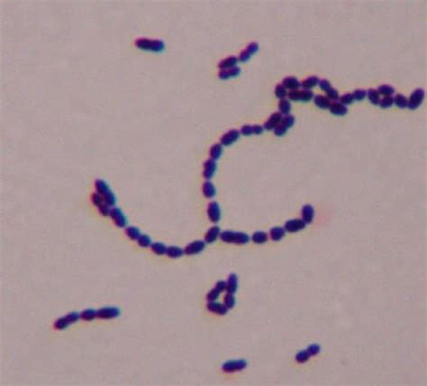 Streptococcus pyogenes | Cocci in chains | Gram (+)