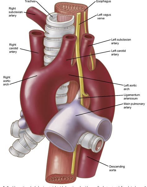 Figure 1 from Anatomy of the thoracic aorta and of its branches ...