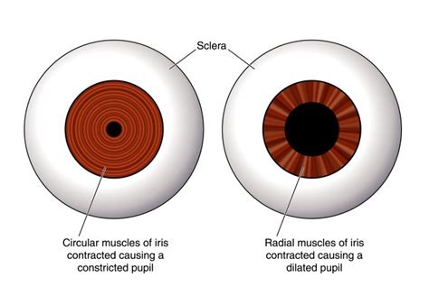 Hippus Pupil Reaction