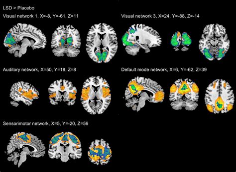 Acute effects of lysergic acid diethylamide (LSD) on resting brain function