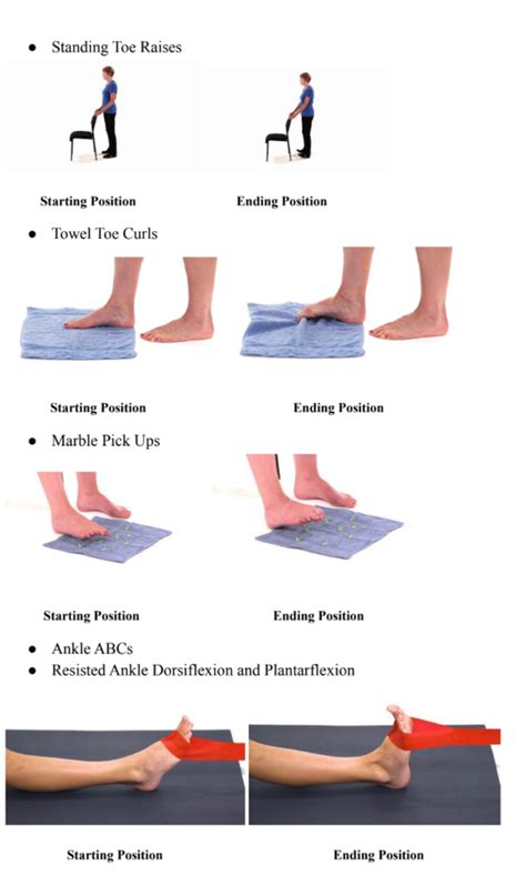 Peroneal Nerve Injury Symptoms Causes Treatment Exercises | sexiezpix ...